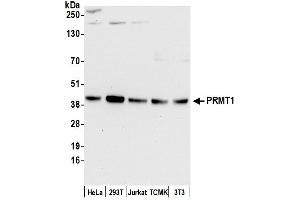 Western Blotting (WB) image for anti-Protein Arginine Methyltransferase 1 (PRMT1) (AA 1-50) antibody (ABIN7453933) (PRMT1 anticorps  (AA 1-50))