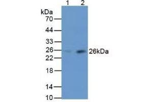 Rabbit Capture antibody from the kit in WB with Positive Control: Sample Lane1: Human Liver Tissue; Lane2: Human Serum.