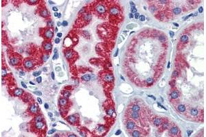 Human Kidney (formalin-fixed, paraffin-embedded) stained with EGR2 antibody ABIN462263 followed by biotinylated goat anti-rabbit IgG secondary antibody ABIN481713, alkaline phosphatase-streptavidin and chromogen.