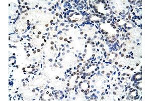 Nucleolin antibody was used for immunohistochemistry at a concentration of 4-8 ug/ml to stain Epithelial cells of renal tubule (arrows) in Human Kidney. (Nucleolin anticorps  (C-Term))