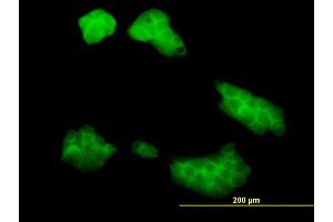 Immunofluorescence of monoclonal antibody to UBE2Q2 on A-431 cell. (UBE2Q2 anticorps  (AA 1-110))