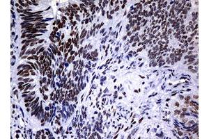 Image no. 9 for anti-Nibrin (NBN) (AA 183-460) antibody (ABIN1491059)