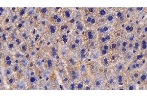 Detection of IL13Ra2 in Mouse Liver Tissue using Polyclonal Antibody to Interleukin 13 Receptor Alpha 2 (IL13Ra2)