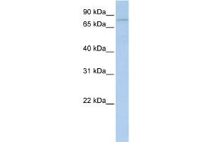 WB Suggested Anti-PYGB Antibody Titration:  0. (PYGB anticorps  (N-Term))