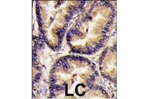 anti-VEGFB (VEGF2) (AA 110-139) antibody