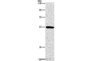 Western blot analysis of Mouse kidney tissue, using ANGPT2 Polyclonal Antibody at dilution of 1:800 (Angiopoietin 2 anticorps)