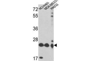 Western Blotting (WB) image for anti-Peroxiredoxin 3 (PRDX3) antibody (ABIN3001722) (Peroxiredoxin 3 anticorps)