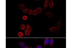 Immunofluorescence analysis of HeLa cells using CYP2A6 Polyclonal Antibody at dilution of 1:100 (40x lens).