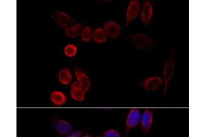 Immunofluorescence analysis of HeLa cells using CYP2A6 Polyclonal Antibody at dilution of 1:100 (40x lens). (CYP2A6 anticorps)