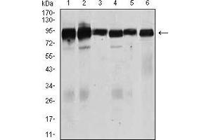 TGFBR3 anticorps  (AA 147-328)