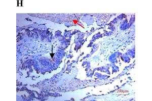 Expression of SPARC in human ovarian tissues using antibody AF941 and bs-1133R.