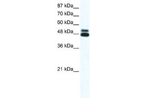 WB Suggested Anti-CHRNB2 Antibody Titration:  0. (CHRNB2 anticorps  (N-Term))