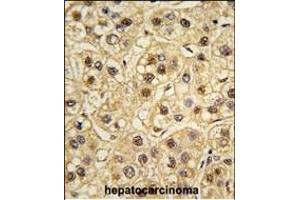 Formalin-fixed and paraffin-embedded human testis tissue reacted with YWHAZ Antibody (ABIN392783 and ABIN2842221) , which was peroxidase-conjugated to the secondary antibody, followed by DAB staining.