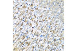 Immunohistochemistry of paraffin-embedded mouse stomach using CST1 antibody (ABIN5975714) at dilution of 1/100 (40x lens). (CST1 anticorps)