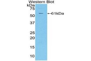 Western Blotting (WB) image for anti-CUB and Zona Pellucida-Like Domains 1 (CUZD1) (AA 218-479) antibody (ABIN1858569)