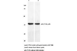 Western blot (WB) analyzes of p38 antibody (MAPK14 anticorps)