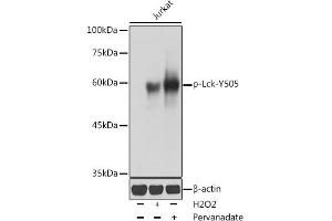 Western blot analysis of extracts of Jurkat cells, using Phospho-Lck-Y505 antibody (ABIN3020027, ABIN3020028, ABIN3020029 and ABIN6225502) at 1:1000 dilution.