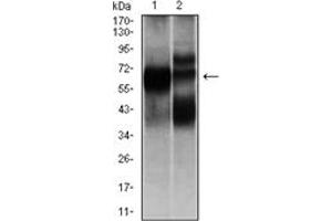 Western Blotting (WB) image for anti-Hexosaminidase A (HEXA) antibody (ABIN1105521) (Hexosaminidase A anticorps)