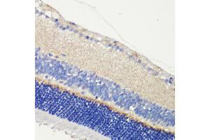 Immunohistochemistry of paraffin-embedded mouse retina using  antibody (ABIN6129704, ABIN6136903, ABIN6136905 and ABIN6216979) at dilution of 1:200 (40x lens). (Anoctamin 2 anticorps  (AA 1-200))