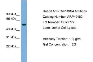 WB Suggested Anti-TMPRSS4  Antibody Titration: 0.