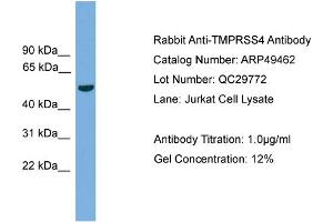 WB Suggested Anti-TMPRSS4  Antibody Titration: 0. (TMPRSS4 anticorps  (N-Term))