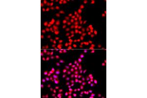 Immunofluorescence analysis of A549 cell using TTBK2 antibody. (TTBK2 anticorps)
