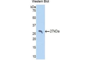Detection of Recombinant SAP, Rat using Polyclonal Antibody to Serum Amyloid P Component (SAP)