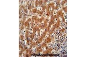 Immunohistochemistry (IHC) image for anti-Pyruvate Kinase (PK) antibody (ABIN2922768)
