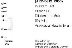 Image no. 2 for anti-Chromosome 21 Open Reading Frame 2 (C21orf2) (N-Term) antibody (ABIN2782373)