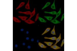 Occludin Mouse Monoclonal Antibody staining Hela cells by IF/ICC. (Occludin anticorps  (Internal Region))