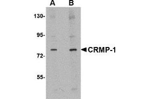 Western Blotting (WB) image for anti-Collapsin Response Mediator Protein 1 (CRMP1) (N-Term) antibody (ABIN1031328) (CRMP1 anticorps  (N-Term))