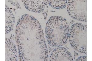 Detection of TICAM1 in Mouse Testis Tissue using Polyclonal Antibody to Toll Like Receptor Adaptor Molecule 1 (TICAM1)