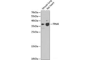 Western blot analysis of extracts of various cell lines using TPM4 Polyclonal Antibody at dilution of 1:1000. (Tropomyosin 4 anticorps)