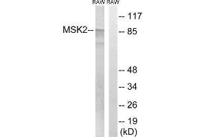 Western Blotting (WB) image for anti-Ribosomal Protein S6 Kinase A4 (RPS6KA4) (Thr568) antibody (ABIN1848240) (MSK2 anticorps  (Thr568))