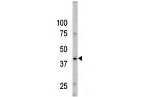 The anti-Phospho-Caspase 9- Pab (ABIN389526 and ABIN2839575) is used in Western blot to detect Phospho-Caspase 9- in Y79 cell line lysates. (Caspase 9 anticorps  (pSer196))