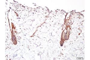 Paraformaldehyde-fixed, paraffin embedded human skin, Antigen retrieval by boiling in sodium citrate buffer (pH6.