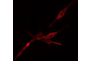 ABIN6274519 staining Hela cells by IF/ICC. (DCP1A anticorps  (Internal Region))