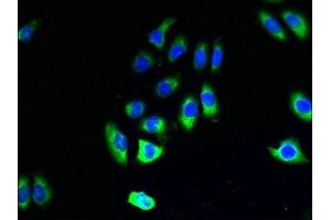 Immunofluorescent analysis of A549 cells using ABIN7154340 at dilution of 1:100 and Alexa Fluor 488-congugated AffiniPure Goat Anti-Rabbit IgG(H+L)