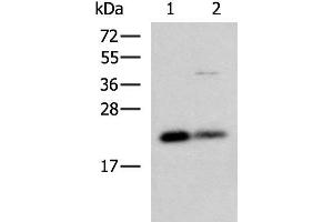 Western blot analysis of HepG2 and A549 cell lysates using CSRP2 Polyclonal Antibody at dilution of 1:900 (CSRP2 anticorps)