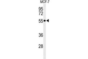 Western Blotting (WB) image for anti-Pre-mRNA Processing Factor 19 (PRPF19) antibody (ABIN3002151) (PRP19 anticorps)