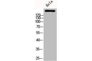 Western Blot analysis of HELA cells using Phospho-ACCα (S80) Polyclonal Antibody (Acetyl-CoA Carboxylase alpha anticorps  (pSer80))