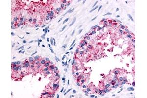 Immunohistochemical staining of Prostate (Epithelium) using anti- OR51E2 antibody ABIN122638