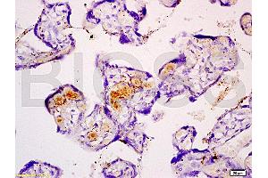 Formalin-fixed and paraffin embedded human placenta tissue with Anti-Fibulin 5 Polyclonal Antibody (ABIN728473), Unconjugated at 1:200, followed by conjugation to the secondary antibody and DAB staining (Fibulin 5 anticorps  (AA 101-200))