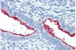Human Uterus (formalin-fixed, paraffin-embedded) stained with MUC16 antibody ABIN351551 at 10 ug/ml followed by biotinylated anti-mouse IgG secondary antibody ABIN481714, alkaline phosphatase-streptavidin and chromogen. (MUC16 anticorps)