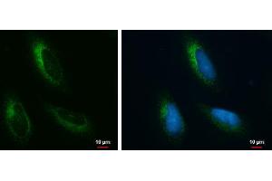 ICC/IF Image Grp78 antibody [N2C1], Internal detects Grp78 protein at endoplasmic reticulum by immunofluorescent analysis. (GRP78 anticorps  (Internal Region))