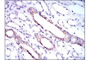 Immunohistochemical analysis of paraffin-embedded kidney tissues using RPL18A mouse mAb with DAB staining. (RPL18A anticorps  (AA 50-176))