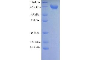 SDS-PAGE (SDS) image for Dipeptidyl-Peptidase 6 (DPP6) (AA 111-859), (Extracellular) protein (His tag) (ABIN5709419)