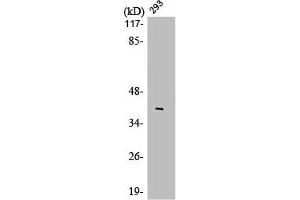 Western Blot analysis of 293 cells using LMO4 Polyclonal Antibody (LMO4 anticorps  (C-Term))