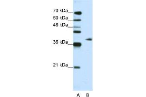 WB Suggested Anti-ADAT1 Antibody Titration:  1. (ADAT1 anticorps  (C-Term))