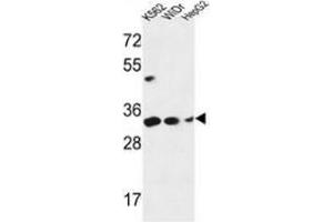 Western blot analysis of PYCR1 (arrow) in K562, WiDr, HepG2 cell line lysates (35ug/lane) using PYCR1  Antibody (C-term). (PYCR1 anticorps  (C-Term))